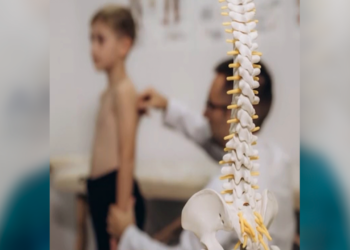 Ofrecen cirugías gratuitas para niños con escoliosis en Chihuahua