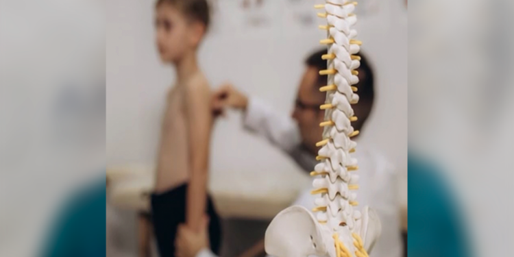 Ofrecen cirugías gratuitas para niños con escoliosis en Chihuahua