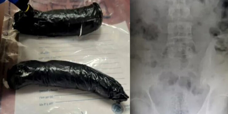 Detienen a hombre con fentanilo oculto en el recto intentando cruzar de Juárez a El Paso