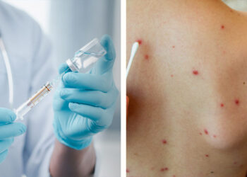 Instalarán módulo de vacunación contra el sarampión en la Presidencia Municipal