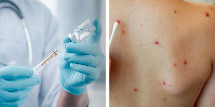 Instalarán módulo de vacunación contra el sarampión en la Presidencia Municipal