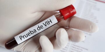 Invitan a practicarse la prueba de VIH en el IMPE de manera gratuita