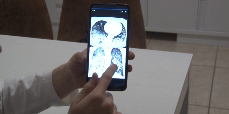 Alertan especialistas sobre riesgos del vapeo en jóvenes