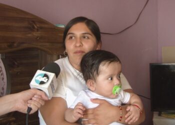 Bebé de 7 meses necesita cirugía urgente por hidrocefalia
