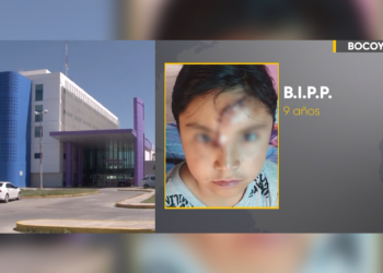 Niña de 9 años fue atacada por un perro en Creel