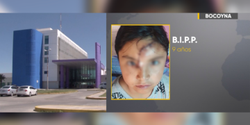 Niña de 9 años fue atacada por un perro en Creel