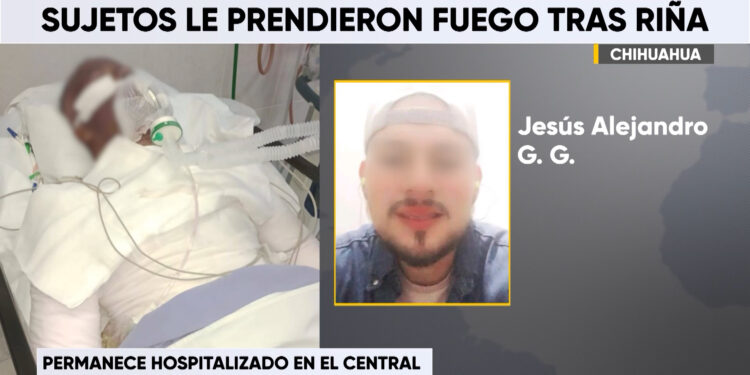 Le prenden fuego a joven motociclista en Villa Juárez