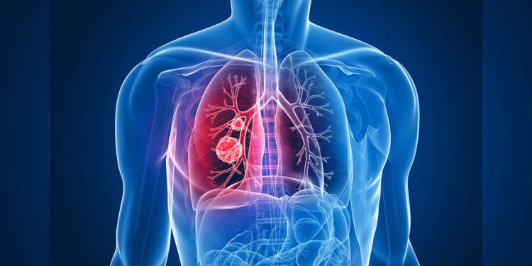 Infecciones respiratorias agudas lideran consultas en la capital al cierre de 2025