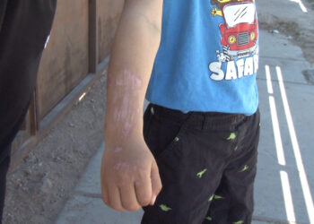 Dan de alta a niño atropellado en parque de Vistas del Norte